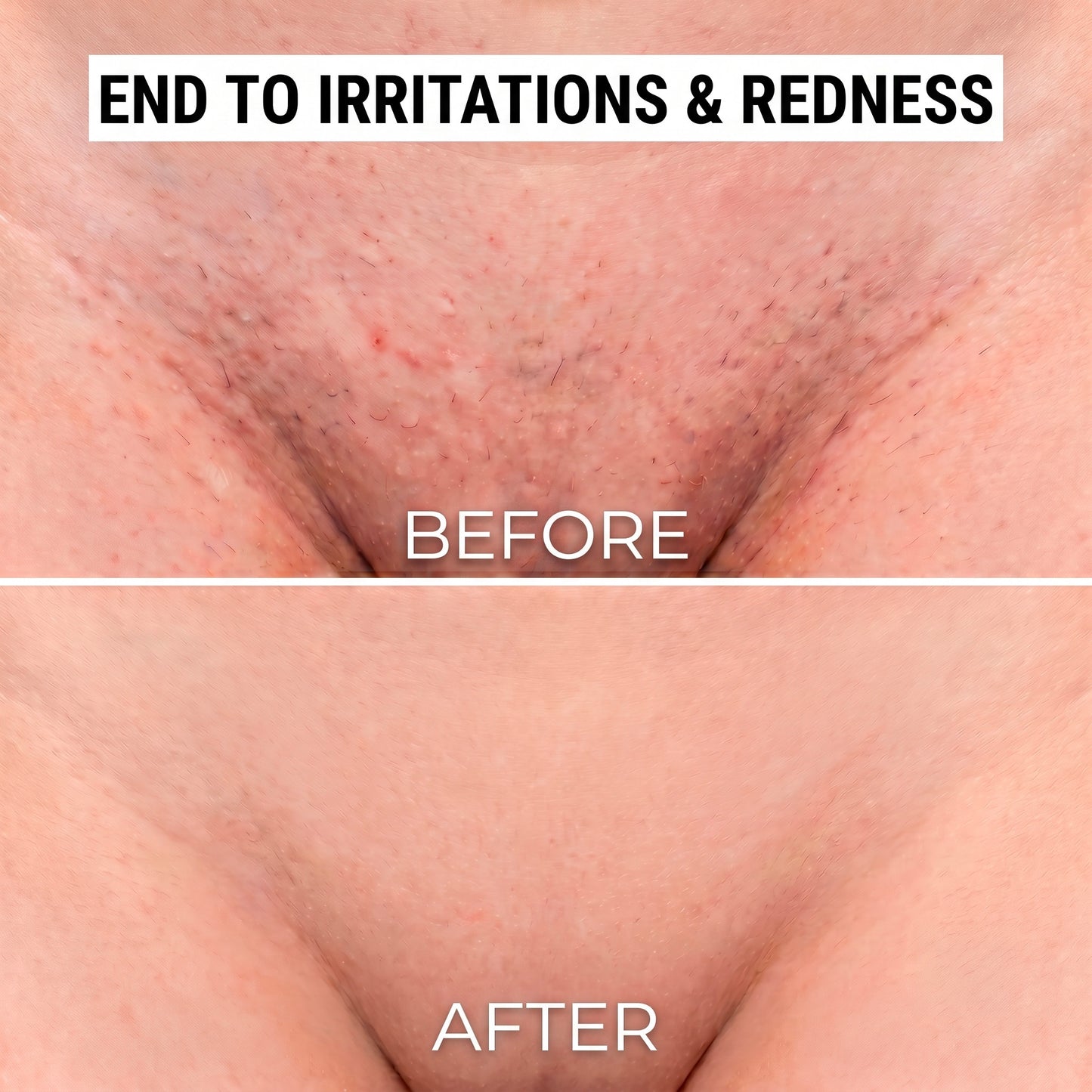 2-in-1 Razor BLENDOE
