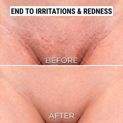 2-in-1 Razor BLENDOE
